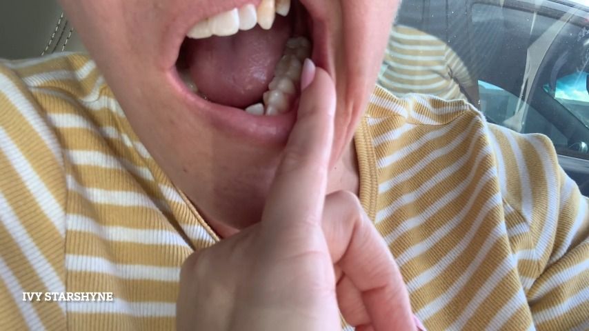 Dental Frustrations + New Mouth Tour - Dec 17, 2022
