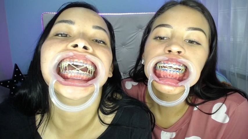 Miaisabella3 Our Mouths Braces And Tongue Tour