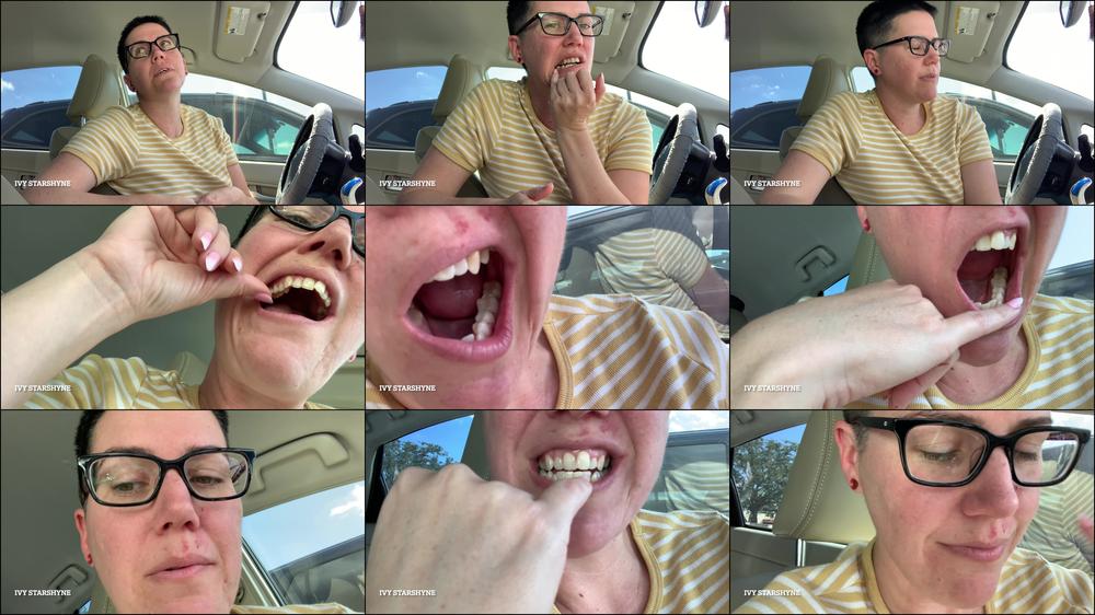 Dental Frustrations + New Mouth Tour - Dec 17, 2022