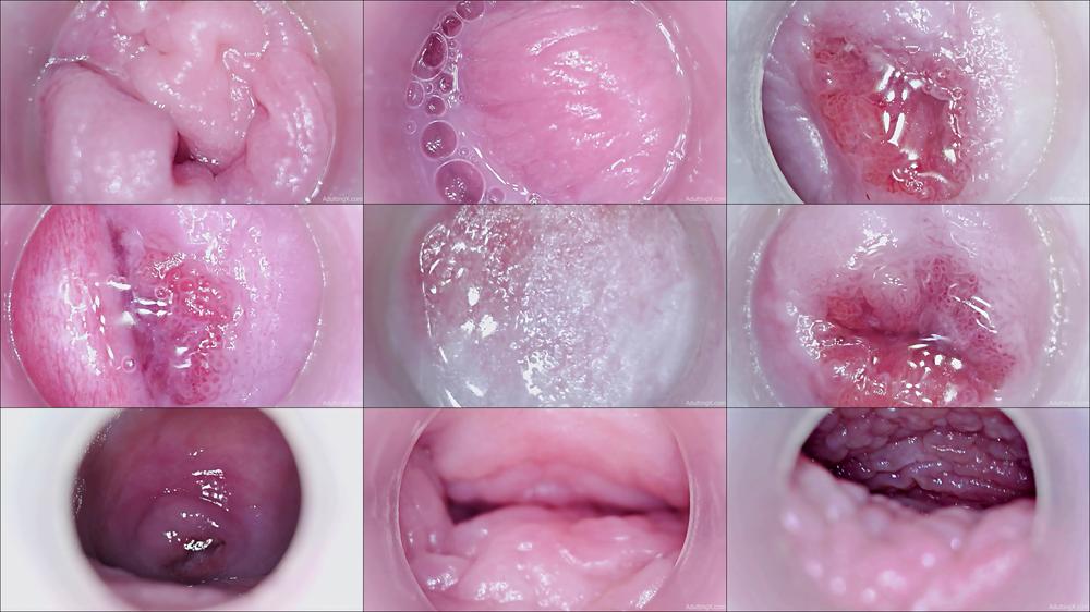 Raw: Magnified Pussy and Cervix - Nov 15, 2021