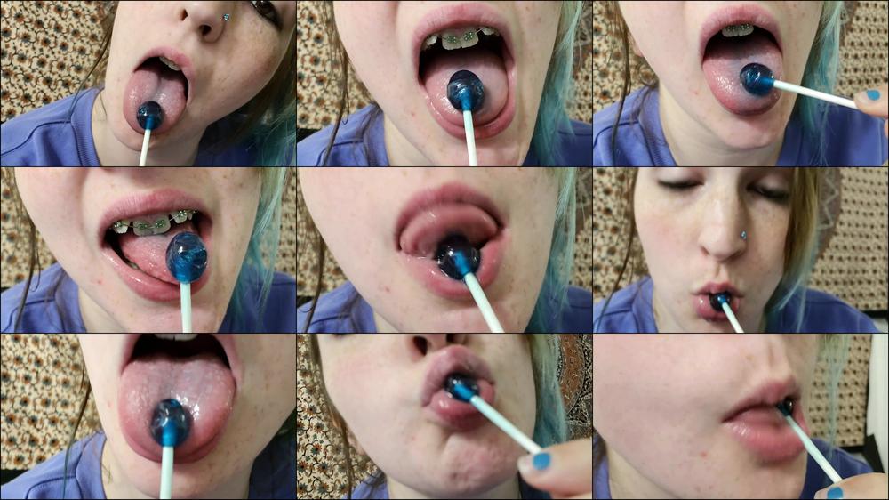 Oral Fixation With Braces Freckles