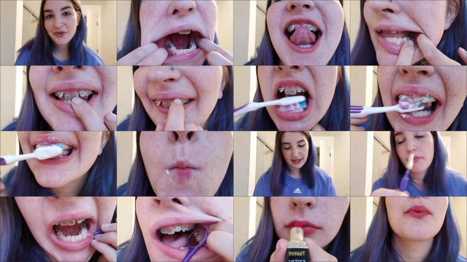 Bigbuttbooty Tour Of Braces With Teeth Brushing