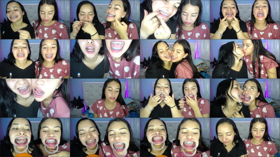 Miaisabella3 Our Mouths Braces And Tongue Tour