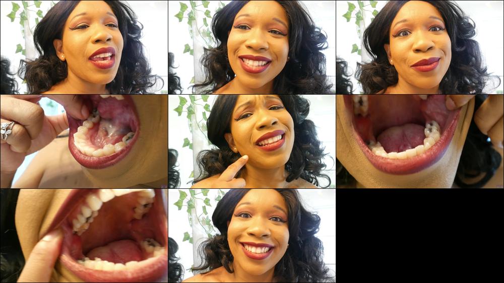 Subbiecupcake Take A Look At My Terrible Teeth