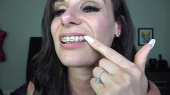 LAUREN'S BRACES & MOUTH TOUR 4K - August 04, 2023 (RoxieRaeFetish)