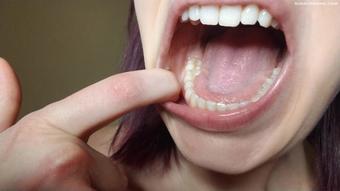 Dental Mouth Exploration (Nina Crowne)