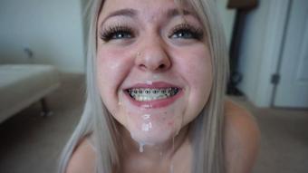 daddy blackmails brace face daughter p2 - Oct 27, 2019 (Katie Sinz)