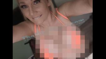 Nikkisexx Nikki Sexx New Fake Tits 1700 Cc Implant (NikkiSexx)