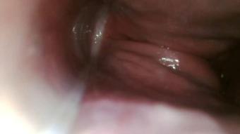 Xamy 97 Endoscope Up My Butt (XAMY_97)