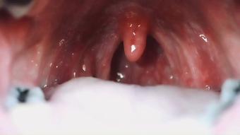Big Mouth (Drea_xoxo)