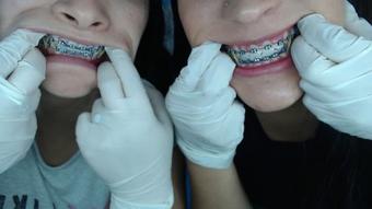 Miaisabella3 Mouth Teeth Braces Inspection (mia_isabella3)