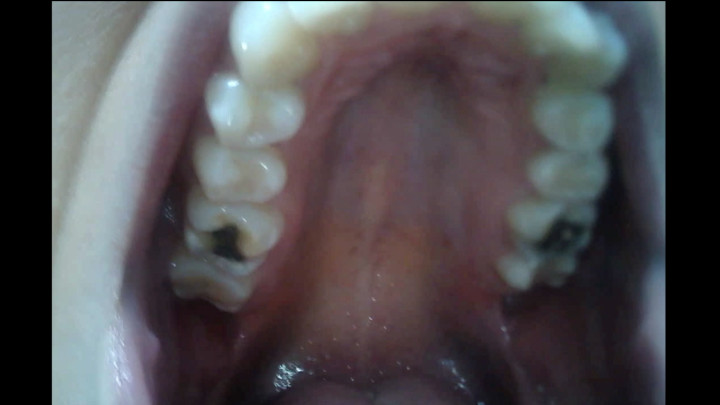 Ivy & Nikki - Endoscope Mouth Tour