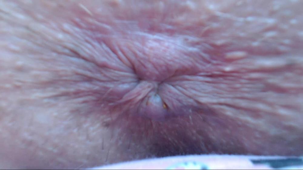 Cuteblonde666 Anal Pulsing Dirty Tight Asshole