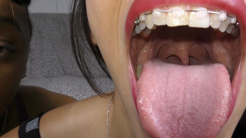 A thorough mouth tour