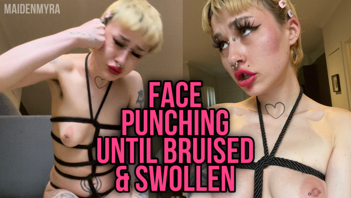 Punching My Face Bruised & Swollen