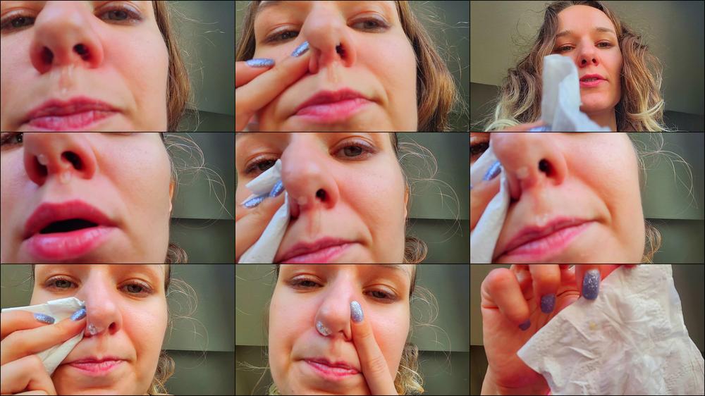 Snotty Flu Nostrils