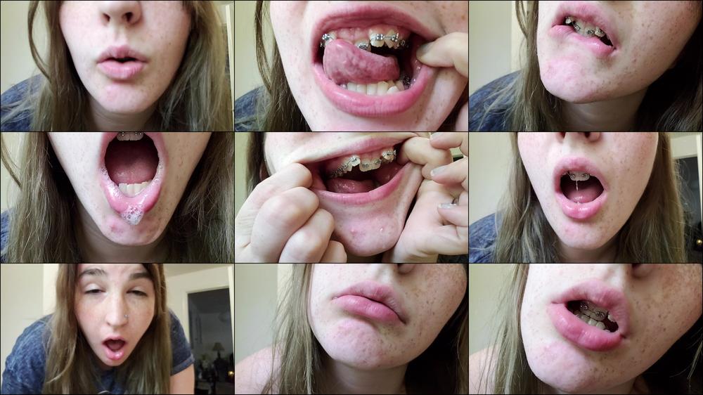 Mouth Spit And Braces Worship