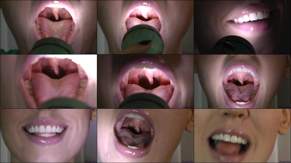 Uvula Fetish - February 18, 2016