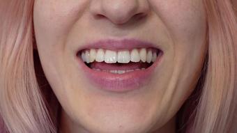 Square Lip Fetish (Sofie Skye)