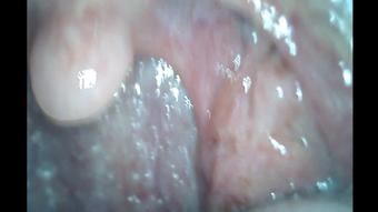 Dustin & Toby Endoscope Mouth Tour (Ginary)