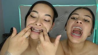 Miaisabella3 Elastic Change Braces Teeth (mia_isabella3)