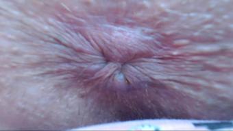 Cuteblonde666 Anal Pulsing Dirty Tight Asshole (cuteblonde666)