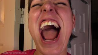 Vanessa Rain Shows Off Teeth (Ginary)
