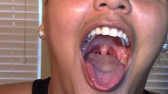 Vanessa Cheeks Mouth (Alexis Rain)