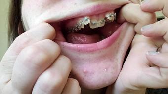 Mouth Spit And Braces Worship (Paige Steele)