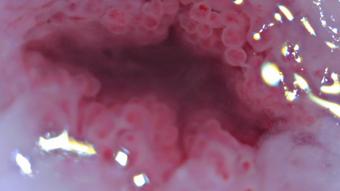 Cervix Closeup Heartbeat 4K - Nov 16, 2021 (adulting)